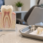 Tooth model and extracted tooth illustrating root canal vs tooth extraction